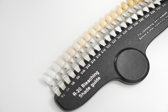 オフィスホワイトニングで歯の色をチェックするシェードガイド