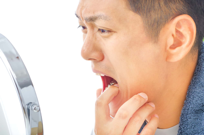 再発した虫歯が痛む男性